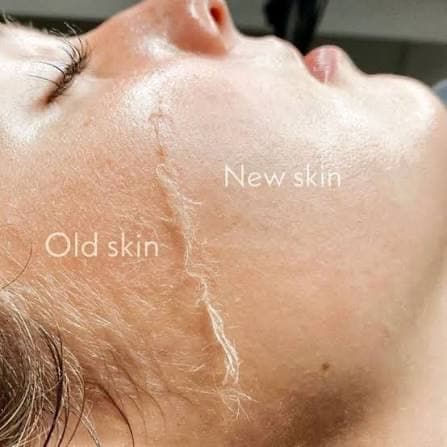 The Renewal at Nurse Ink/Rao Med Spa in Covington, LA
